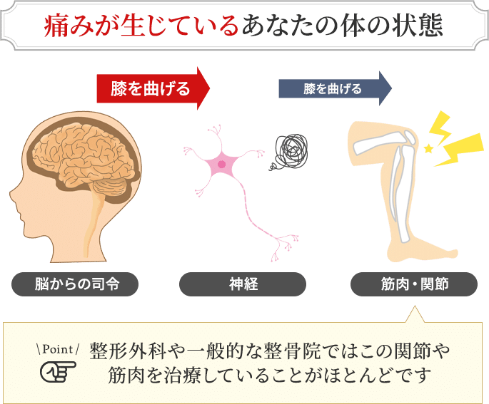 痛みが生じているあなたの体の状態
